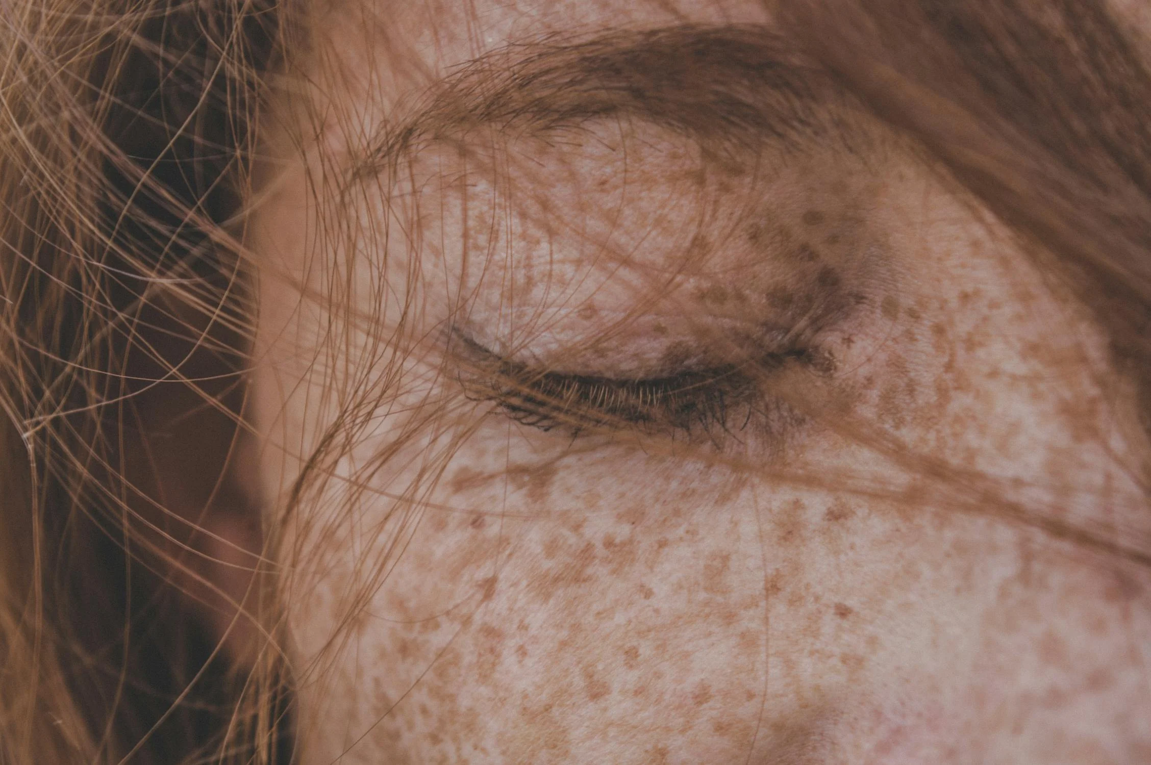 Dermatología